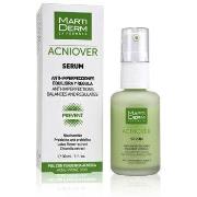 Soins ciblés Martiderm Sérum Acniover