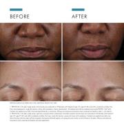 SkinCeuticals Cell Cycle Catalyst 30 ml