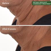 Murad Retinal ReSculpt Overnight Treatment 30ml