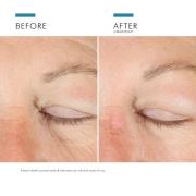 SkinCeuticals A.G.E. Advanced Eye Crème pour Cernes et Ridules 15 ml